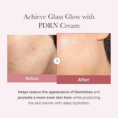 Medicube PDRN Pink Hyaluronic Moisturizing Cream