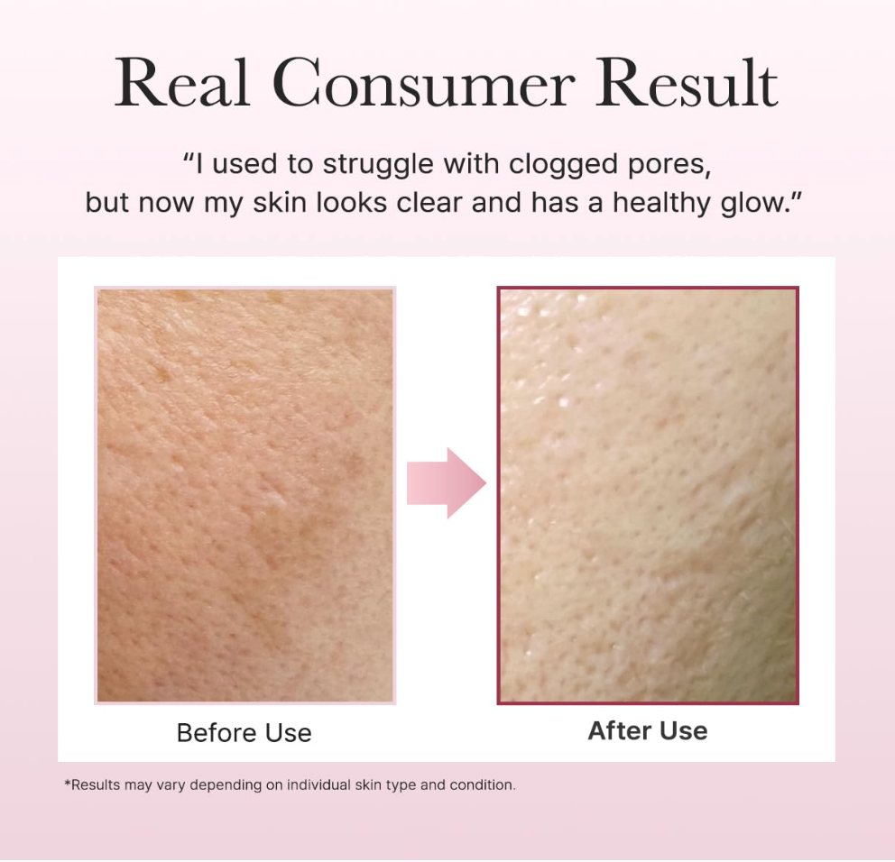 Arencia Fresh Rosehip Rice Mochi Cleanser