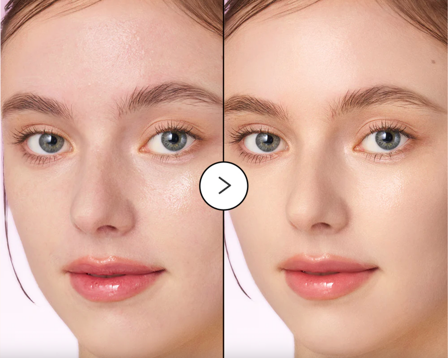 Eqqualberry Purple PDRN Pore Serum